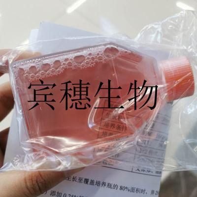 U118-MG人脑星形胶质母细胞瘤细胞系全年优惠