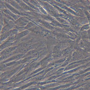 卵巢颗粒细胞瘤细胞KGN 