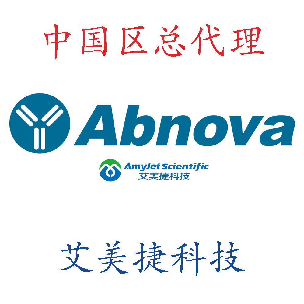 CEA单克隆抗体/CEA单克隆抗体/CEA单克隆抗体