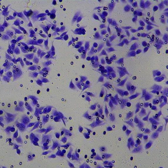 transwell侵袭、迁移实验