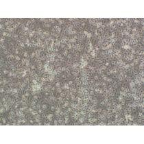 人小气道平滑肌细胞