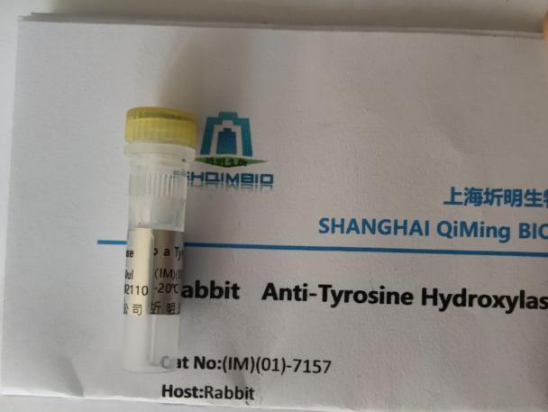 TEM8肿瘤血管内皮标志物8抗体