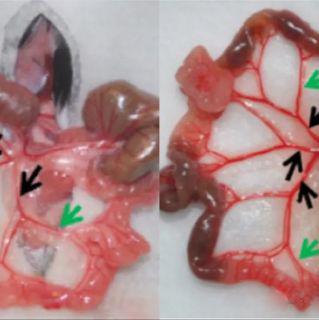 【动物模型】-肠缺血再灌注损伤模型