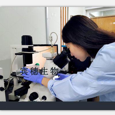 CAL27;人舌鳞状上皮细胞癌复苏率高细胞|配套专用培养基