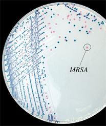 定位显色培养基