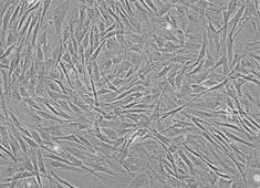 胰腺导管上皮癌细胞,细胞