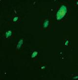 绿色荧光蛋白标记小鼠前胃癌细胞,MFC-GFP细胞