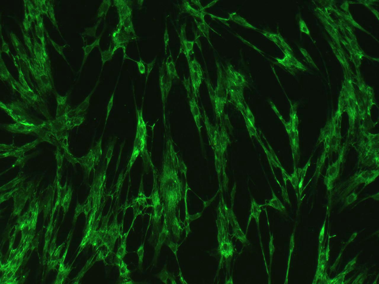 逆转录病毒包装用的鼠胚胎成纤维细胞 PA317细胞 