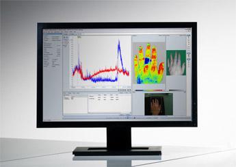 血流灌注成像仪软件 PIMSoft