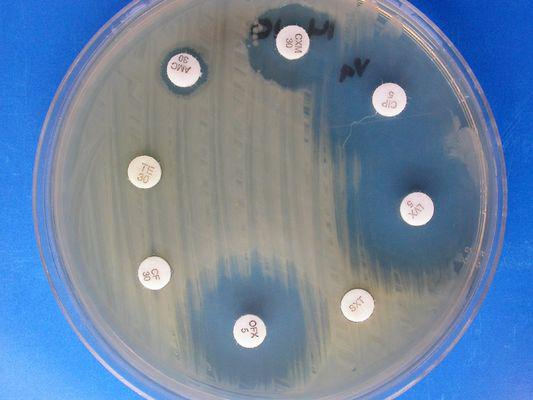 氧化型谷胱甘肽