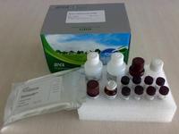 北京现货 人抗软骨抗体(anti-cartilage-Ab)ELISA Kit  特价，报价