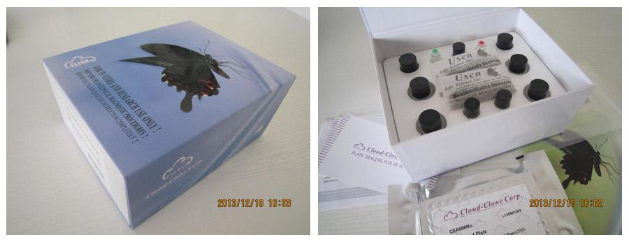 Polyclonal Antibody to Vitamin D Binding Protein (DBP)