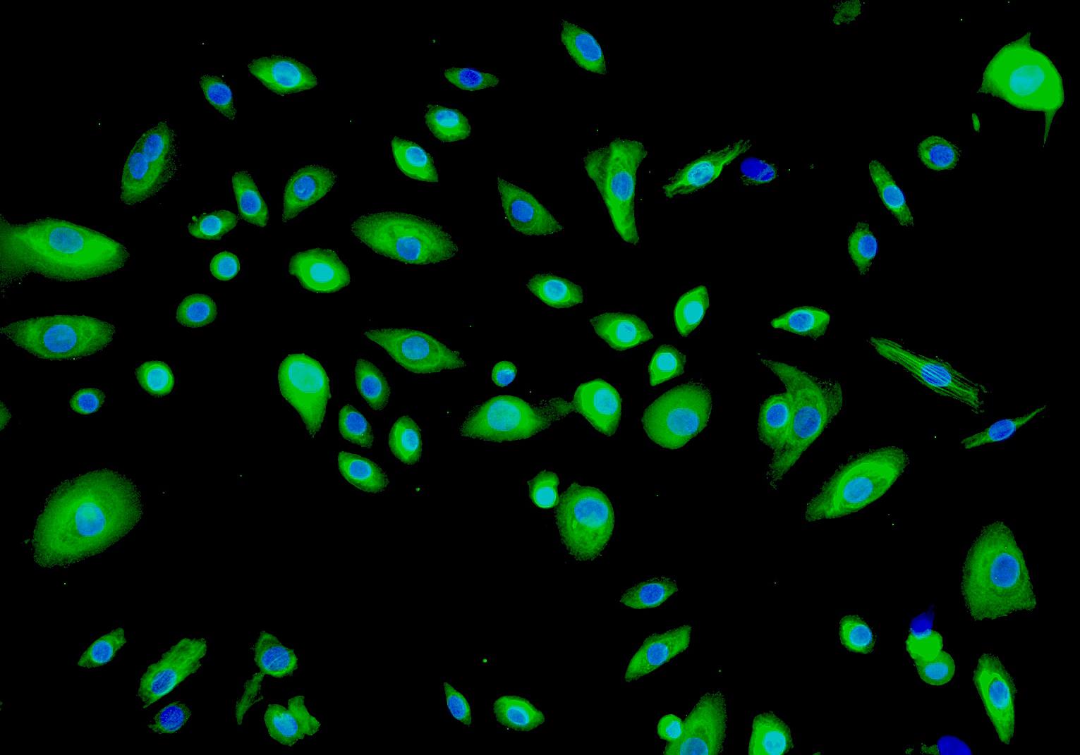 人胸腺上皮细胞
