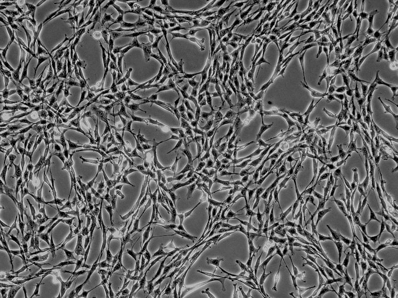 人胸腺成纤维细胞