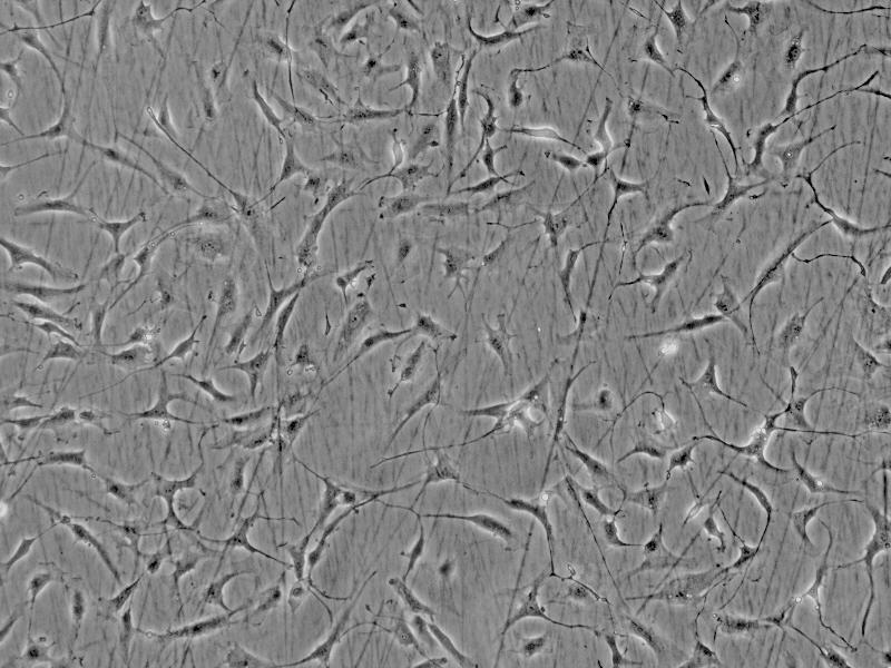 人心脏成纤维细胞-成人