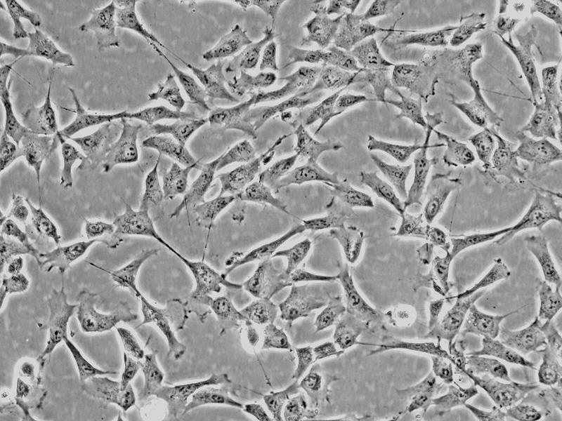 人结膜成纤维细胞