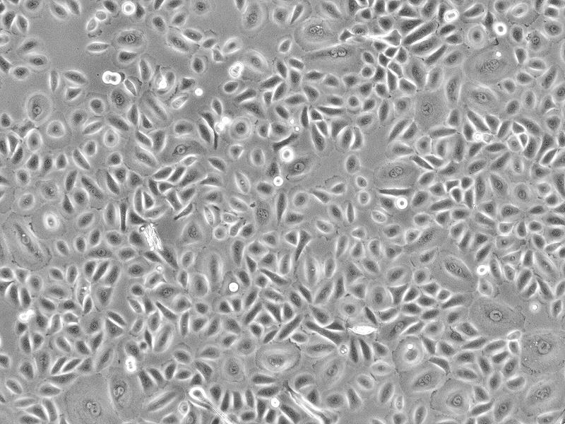 人绒毛膜毛细血管内皮细胞