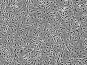 人绒毛膜间充质基质细胞