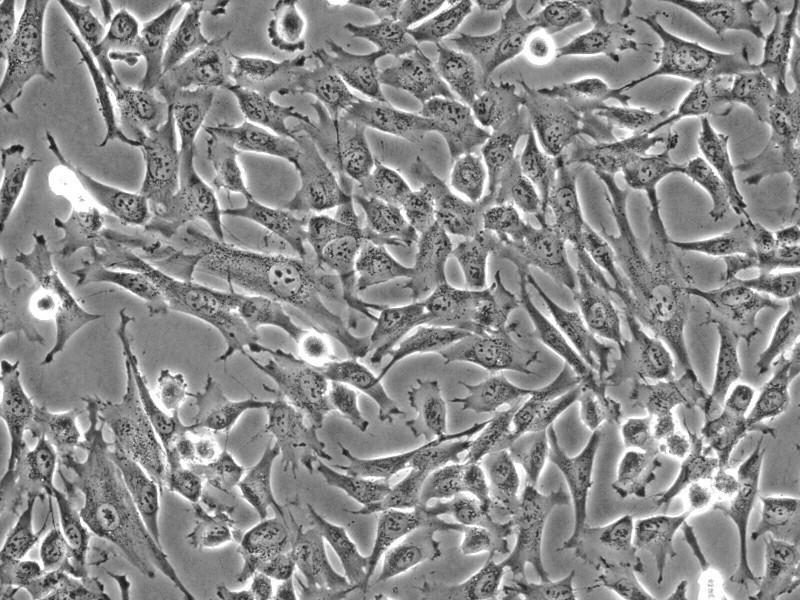 人脐带间充质干细胞 