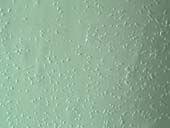 小鼠纹状体神经元 