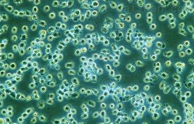 KB 人口腔表皮样癌细胞