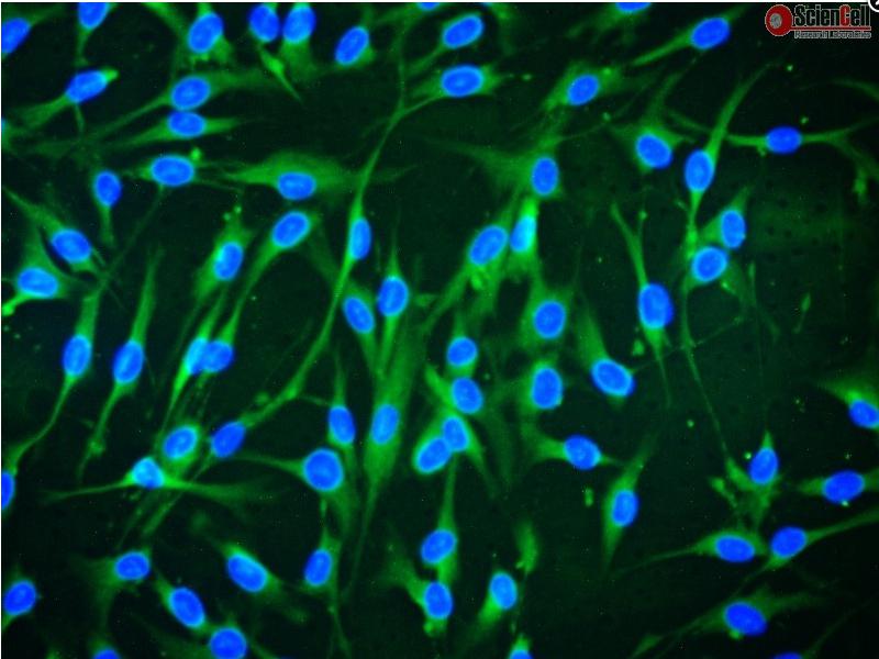 人骨髓间充质干细胞 