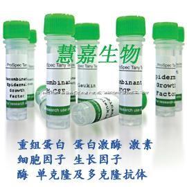   (mTPO)重组小鼠促血小板生成素 -Recombinant Mouse Thrombopoietin