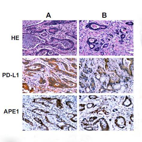 临床实验免疫组化