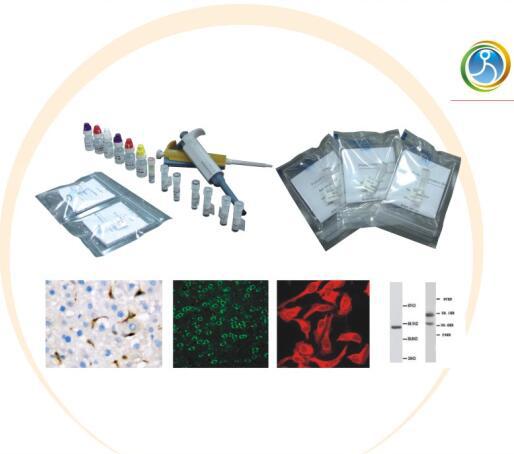 HBcAg 乙肝病毒核心抗原 Antibody