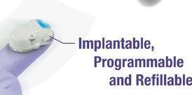 iPRECIO 植入式微量注射泵 