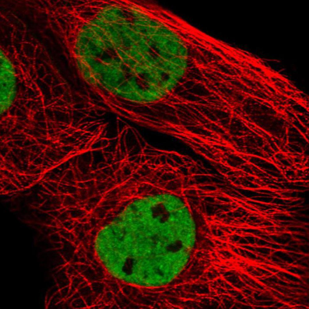 抗体标记试剂盒