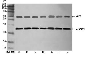 Western blot免疫蛋白印迹，WB