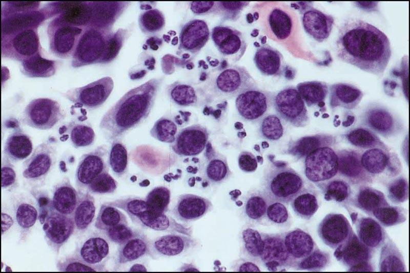 【病毒转染小鼠细胞】PT-67细胞 