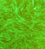 分泌A2抗体B淋巴细胞,NAMALWA细胞