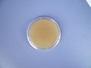 改良罗氏培养基基础