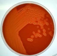 3%氯化钠甘露醇