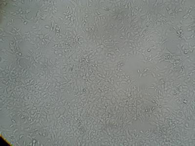 BxPC-3 人 原位胰腺腺癌细胞