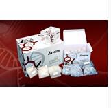 抗苗勒管激素检测试剂盒