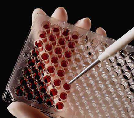 RF/6A 猴脉络膜-视网膜(内皮)细胞