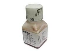 人血清（混合血型）厂家价格，人血清（混合血型）现货