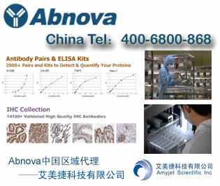 类风湿因子(RF)ELISA试剂盒 | Rheumatoid Factor (RF) ELISA Kit