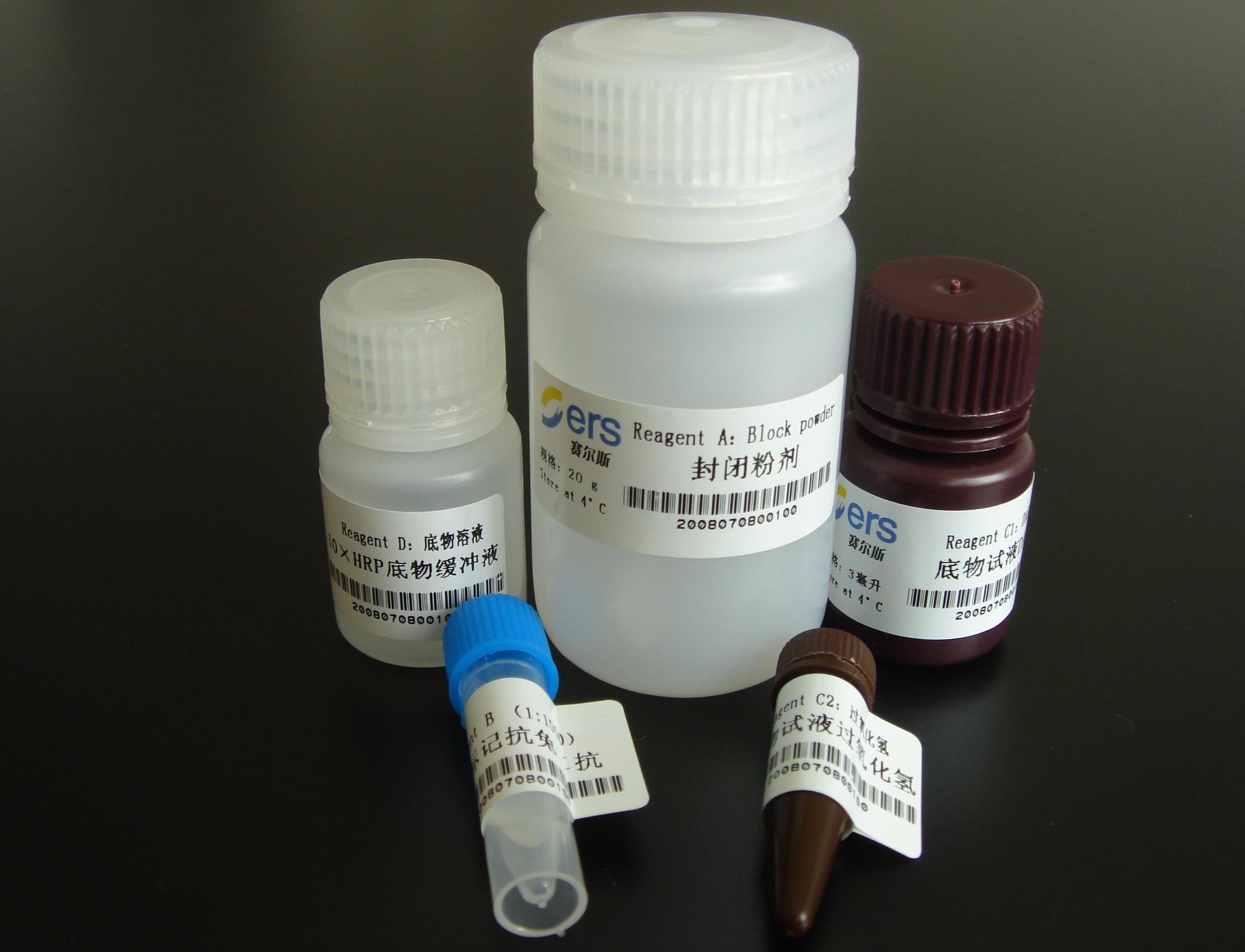 小鼠抗人乙肝核心抗原抗体