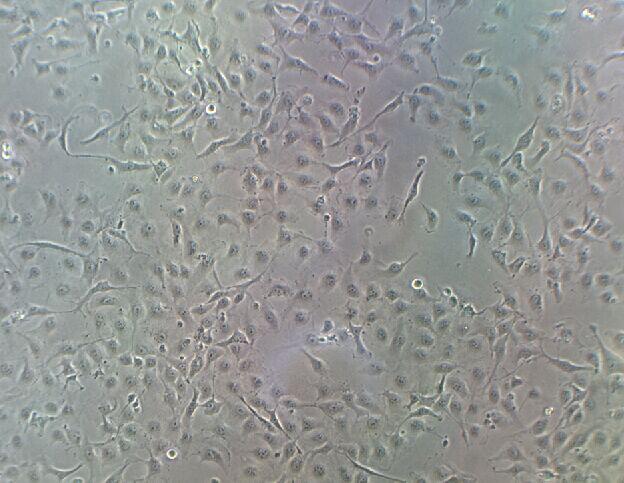 HUVEC人脐静脉血管内皮细胞实验