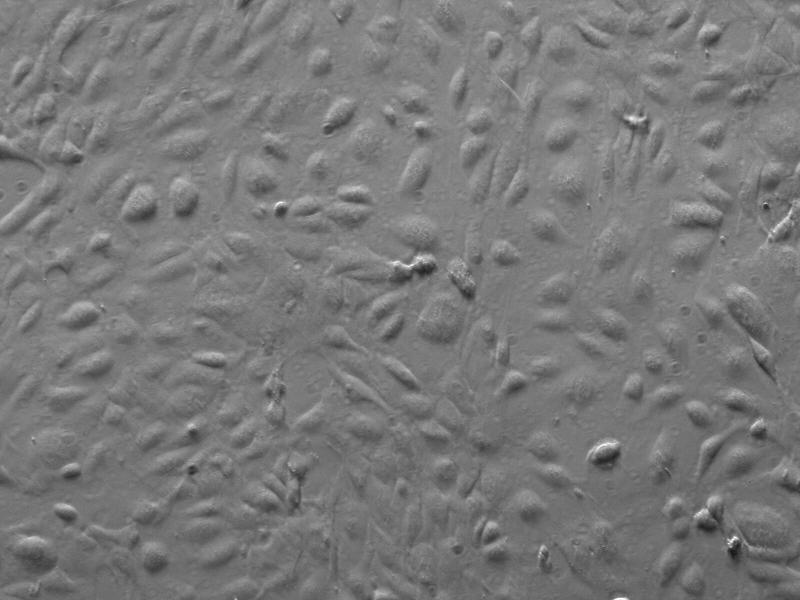 人脑微血管内皮细胞（HBMEC）