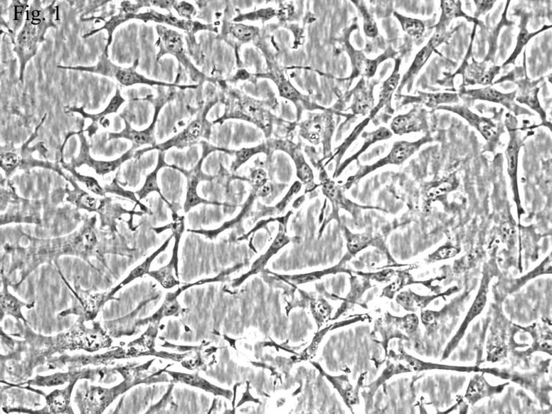 人小脑星形胶质细胞