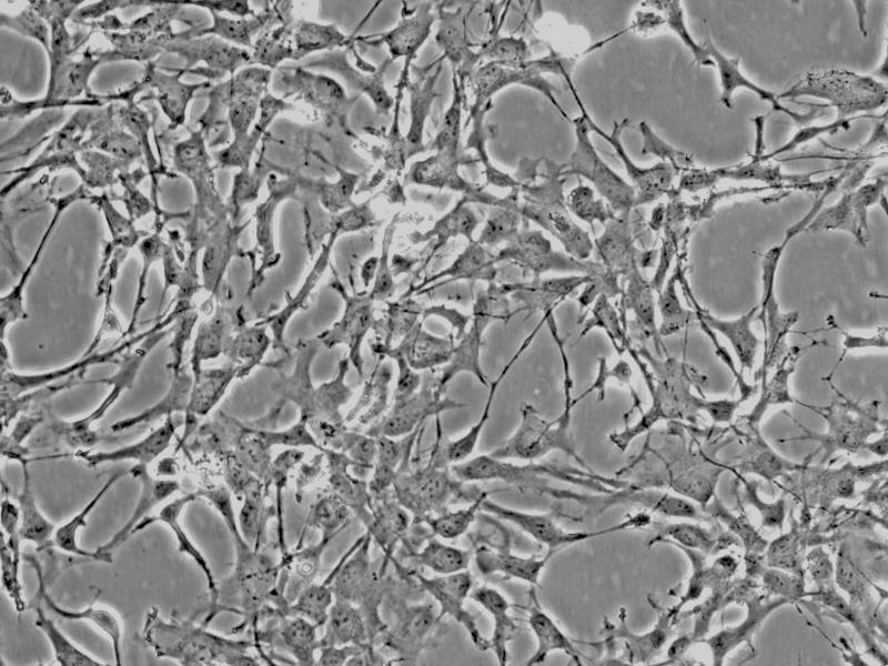 人星形胶质细胞-中脑