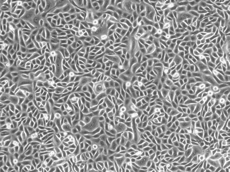 人表皮角质细胞-胎儿