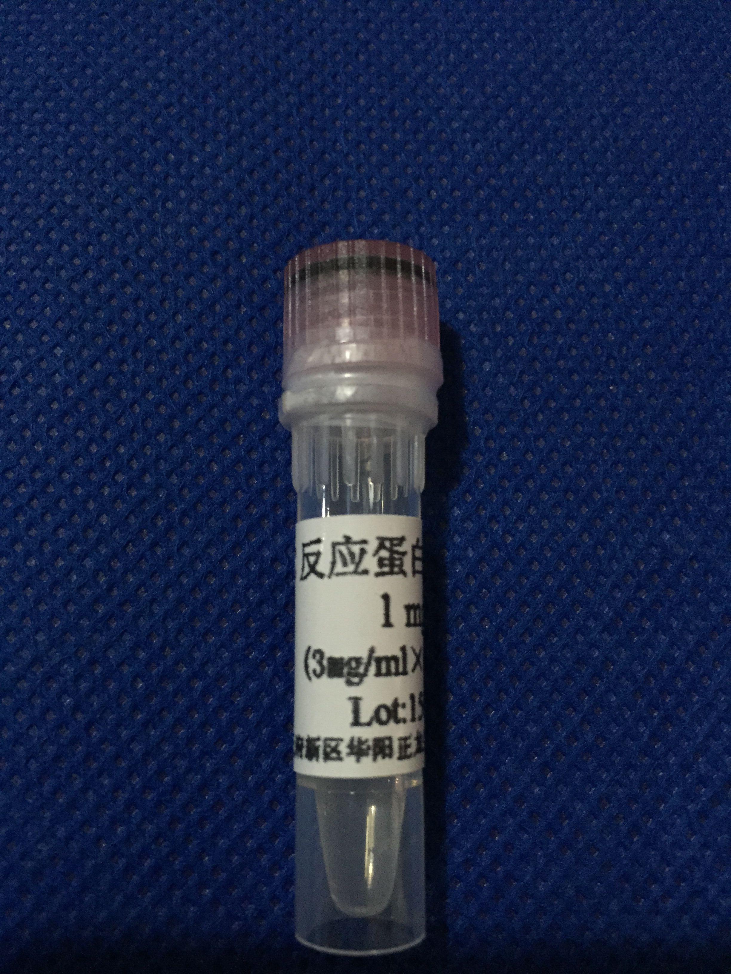  C反应蛋白（CRP）