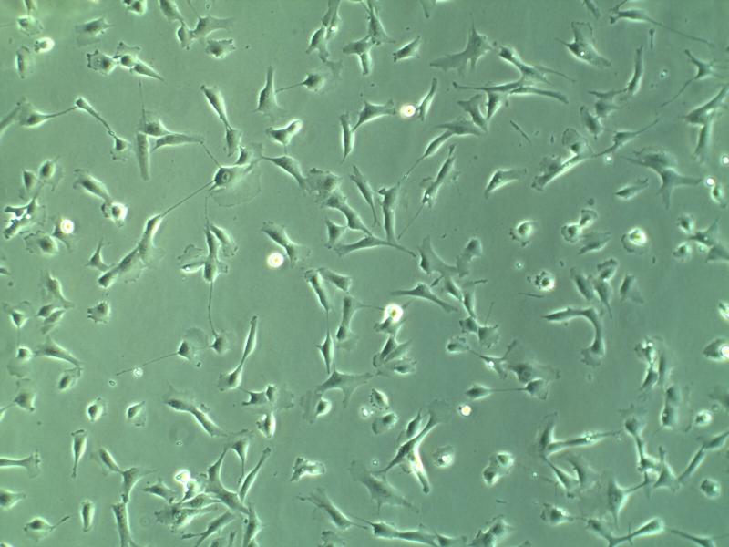 人气管平滑肌细胞