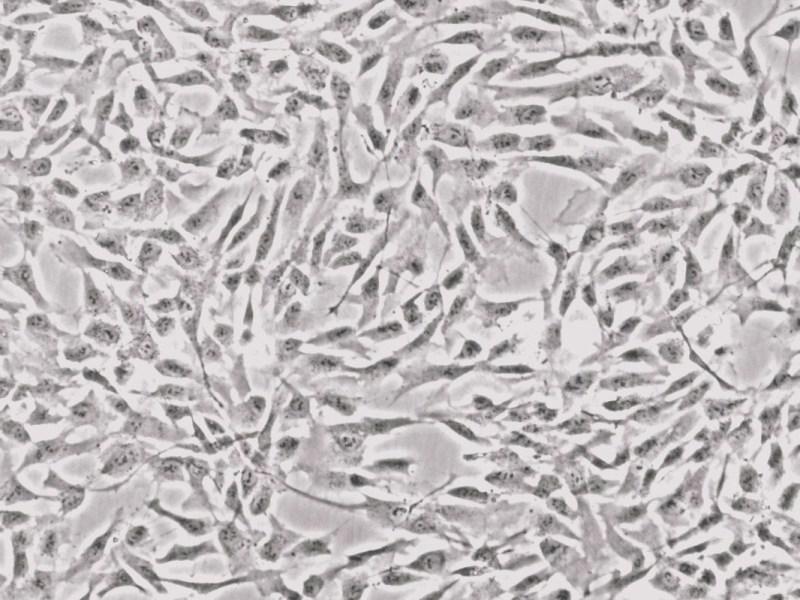 人股骨成骨细胞